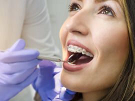 Orthodontist Peoria AZ | Pleasant Dental